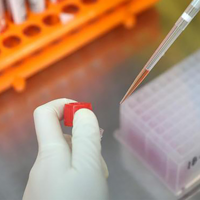 Infektionskrankheit Monkeypox-Virus-Test schnelles kolloidales Gold Igm Igg