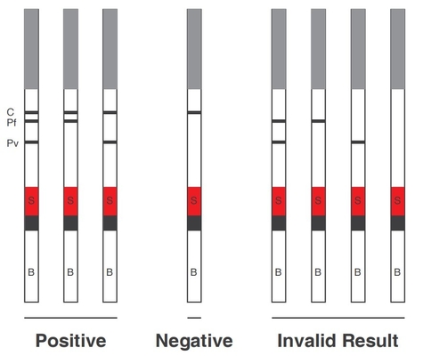 Antigen-Test Malaria PF PV durch kolloidales Test-Reagens des Goldivd