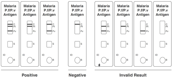 Antigen-schnelles Test-Kit Colloidal Gold-CER der Malaria-PF/PV registriert